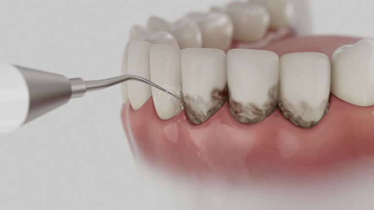 Trusted Dental Implants service in Chillum, MD - Dentist Open Now